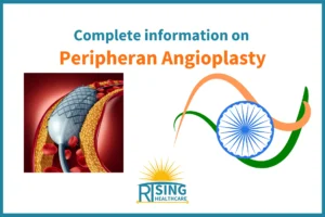 peripheral angioplasty treatment in india