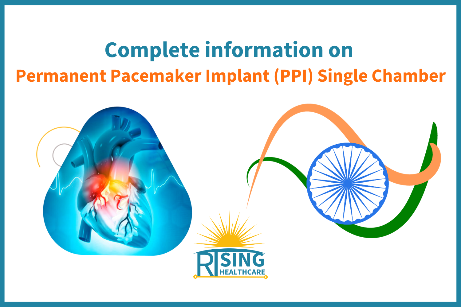 Permanent Pacemaker Implant (PPI) Single Chamber | Rising Health Care ...